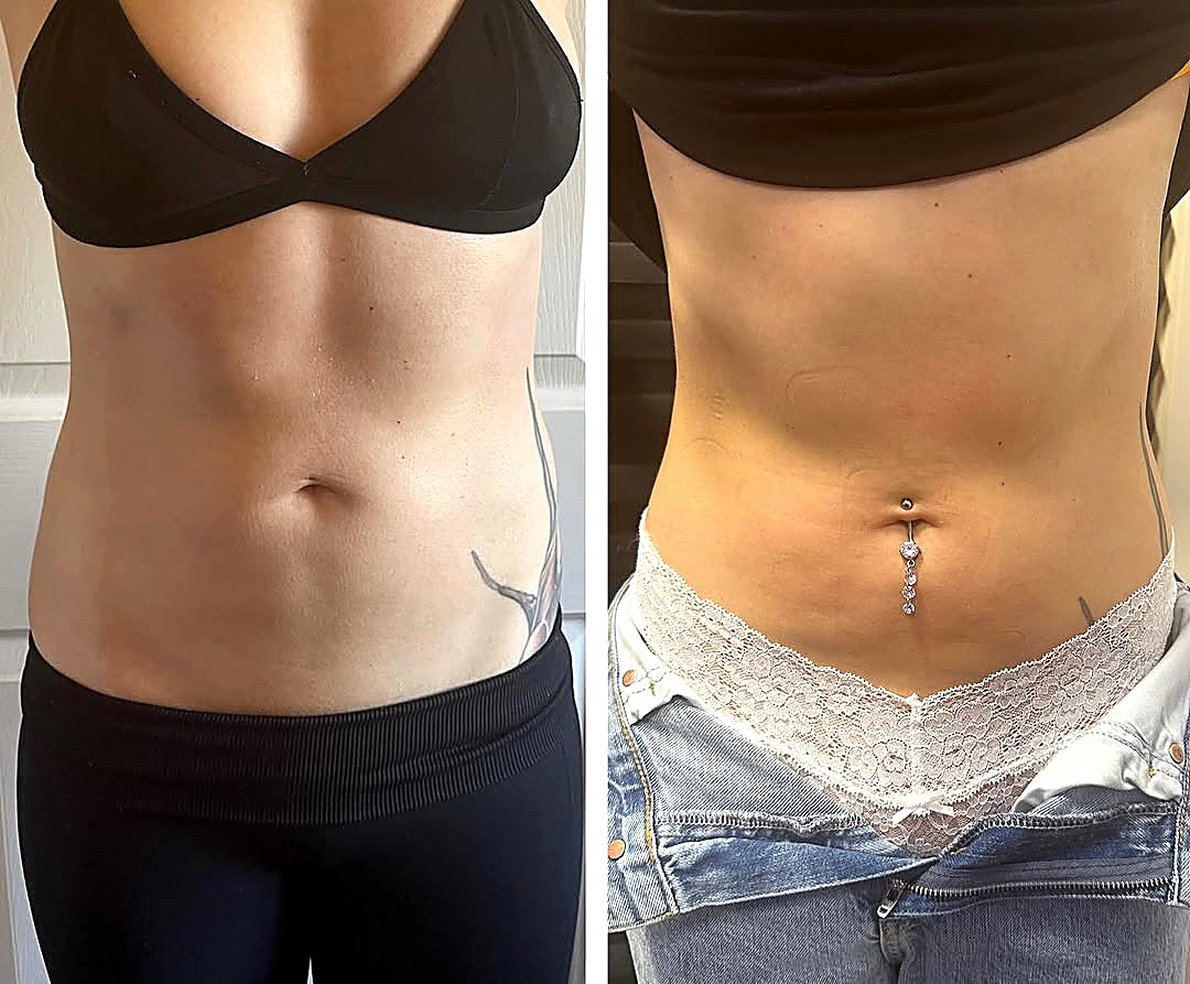 Before and after:waistline